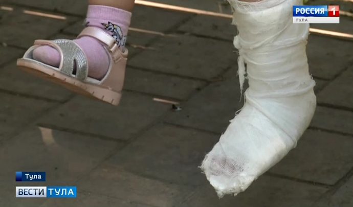 К тульским травматологам потянулась вереница юных пациентов