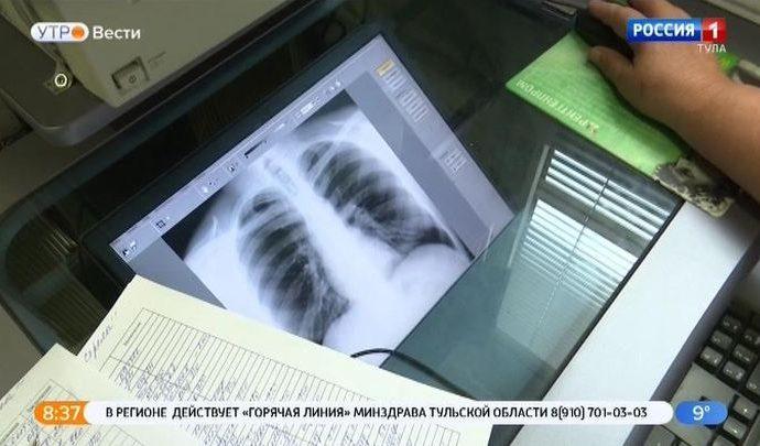 У студентки 1 курса ТГПУ диагностирован туберкулез