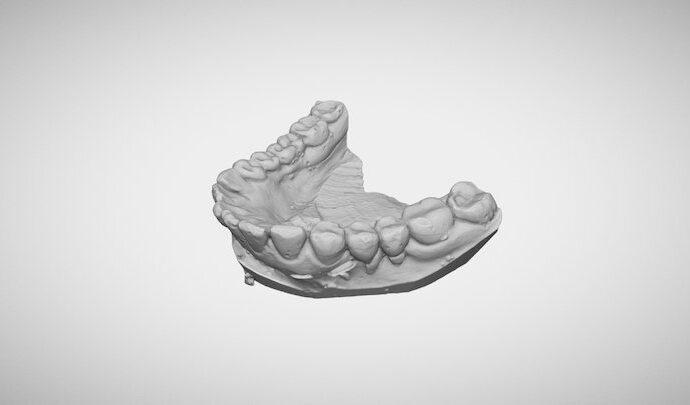 Тульские стоматологи смогут делать протезы с помощью 3D-принтера