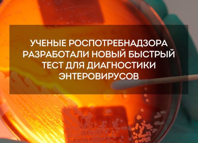 Специалисты ЦНИИ Эпидемиологии Роспотребнадзора разработали инновационный тест для оперативного выявления энтеровирусов в окружающей среде.