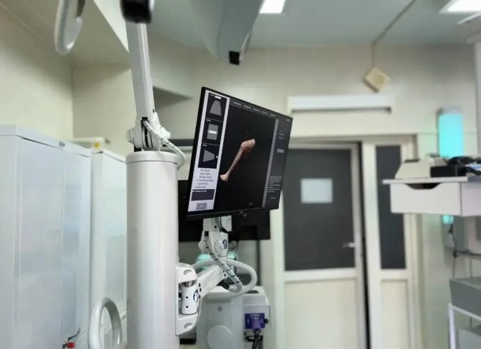 В травматолого-ортопедическом центре Тульской областной клинической больницы внедрили передовую технологию — первого в регионе робота-ассистента для операций на суставах. 